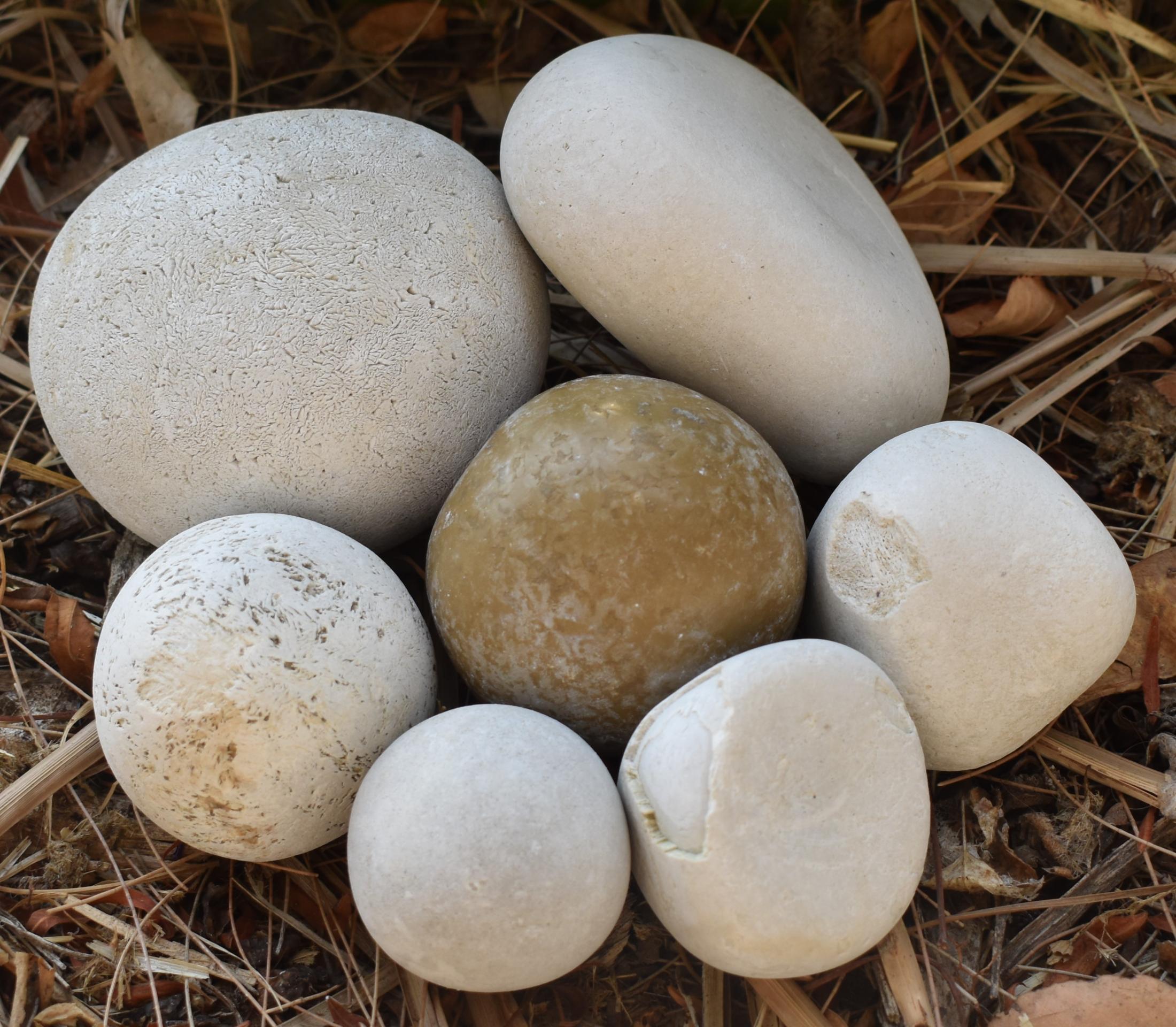 Picture showing enteroliths of various sizes