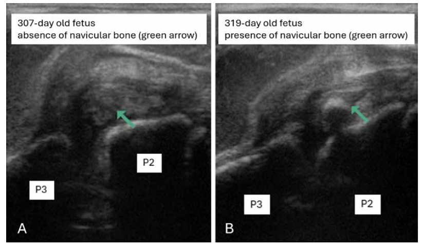 Ultrasound images of the lower limb of a 307-day old fetus and a 319 day old fetus