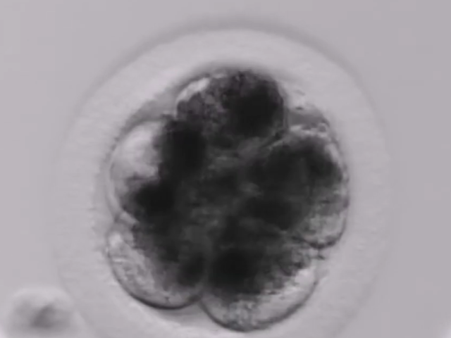A developing horse embryo as seen through a microscope