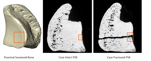 Images of proximal sesamoid bones